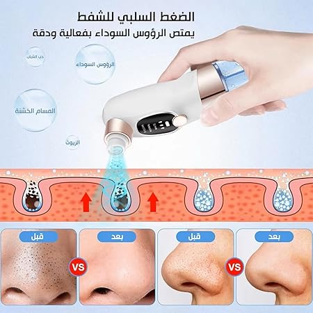 قلم شفط دهون بالمياه