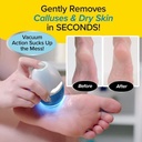 حجر كهربائي لإزالة الجلد الميت من القدمين بسرعة 2000 دورة في الدقيقة